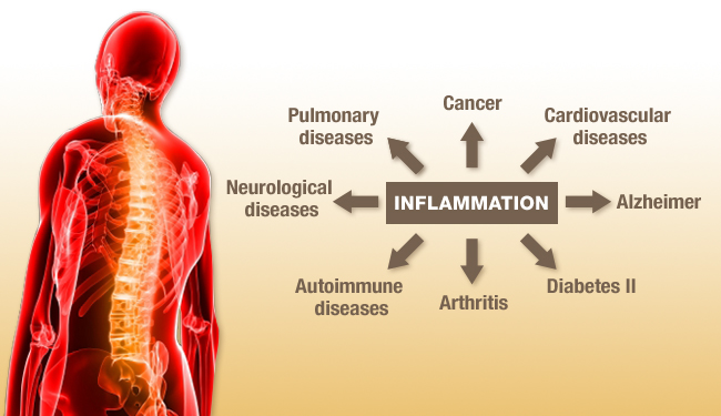 Inflammation[1]